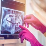Are Dental X-Rays Safe in Salida, CO?